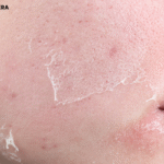 best face products for dry skin