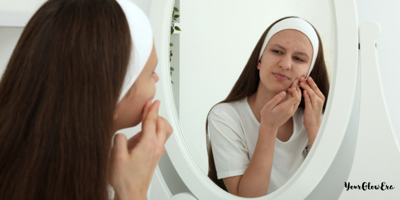 teenage skincare products