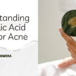 salicylic acid soap for acne