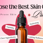 best skin care products for acne prone skin