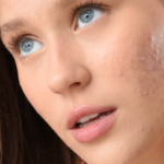 teenage skincare products