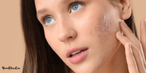 teenage skincare products