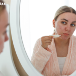 Acne scar treatment price