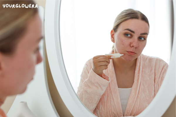Acne scar treatment price