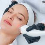 Laser treatment for acne cost in india