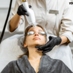 Laser treatment for acne price