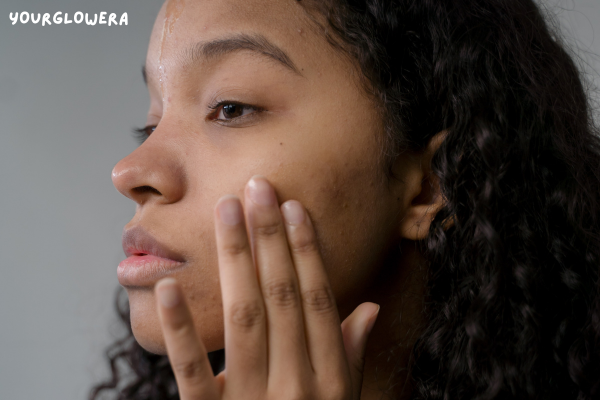 Acne scar treatment price